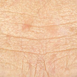 Photo Textures of Human Skin